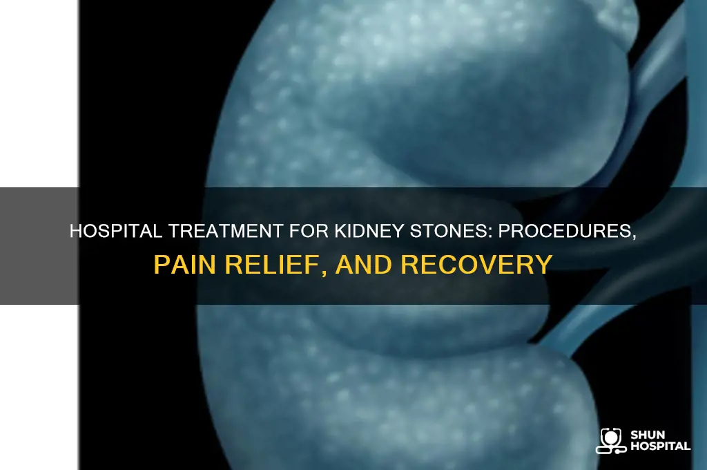what do they do for kidney stones at hospital
