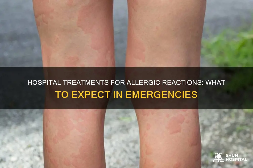 what do they give you in hospital for allergic reaction