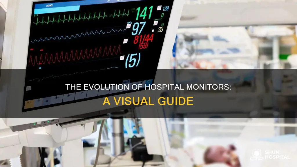 what does a hospital monitor look like