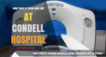 Exploring CT Scan Imaging at Condell Hospital: A Visual Guide