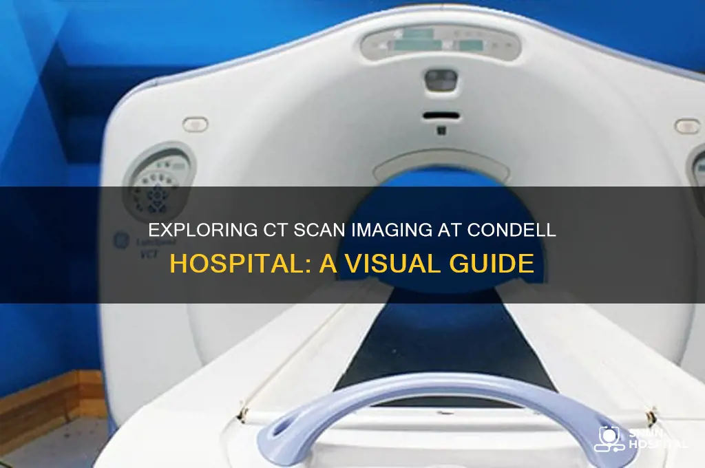 what does ct scan look like at condell hospital