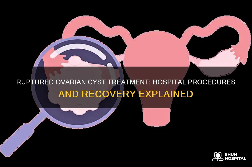 what does the hospital do for a ruptured ovarian cyst