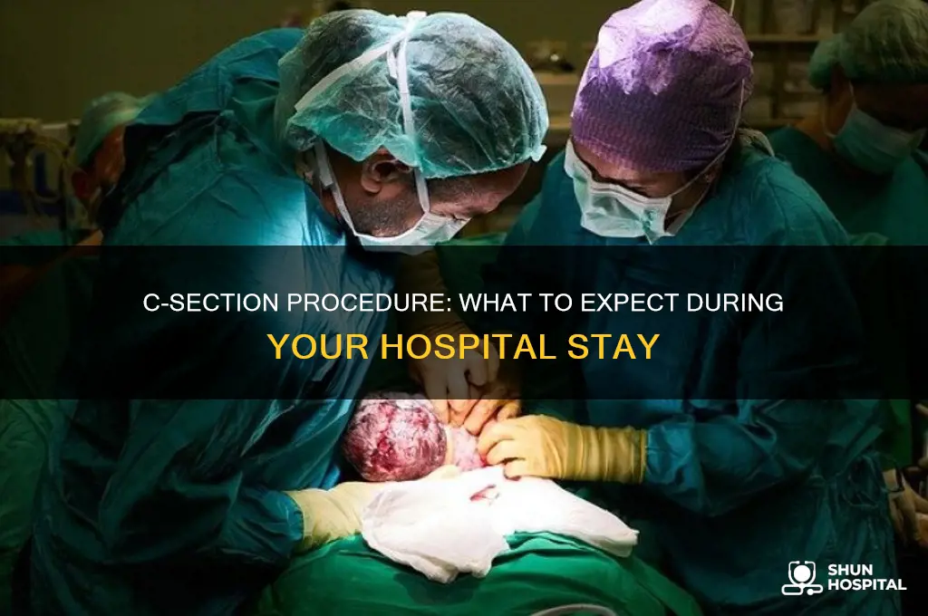 what does the hospital do to you for a csection