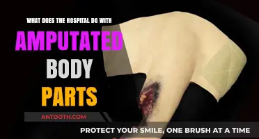 Amputated Body Parts: Hospital Procedures and Ethical Disposal Explained