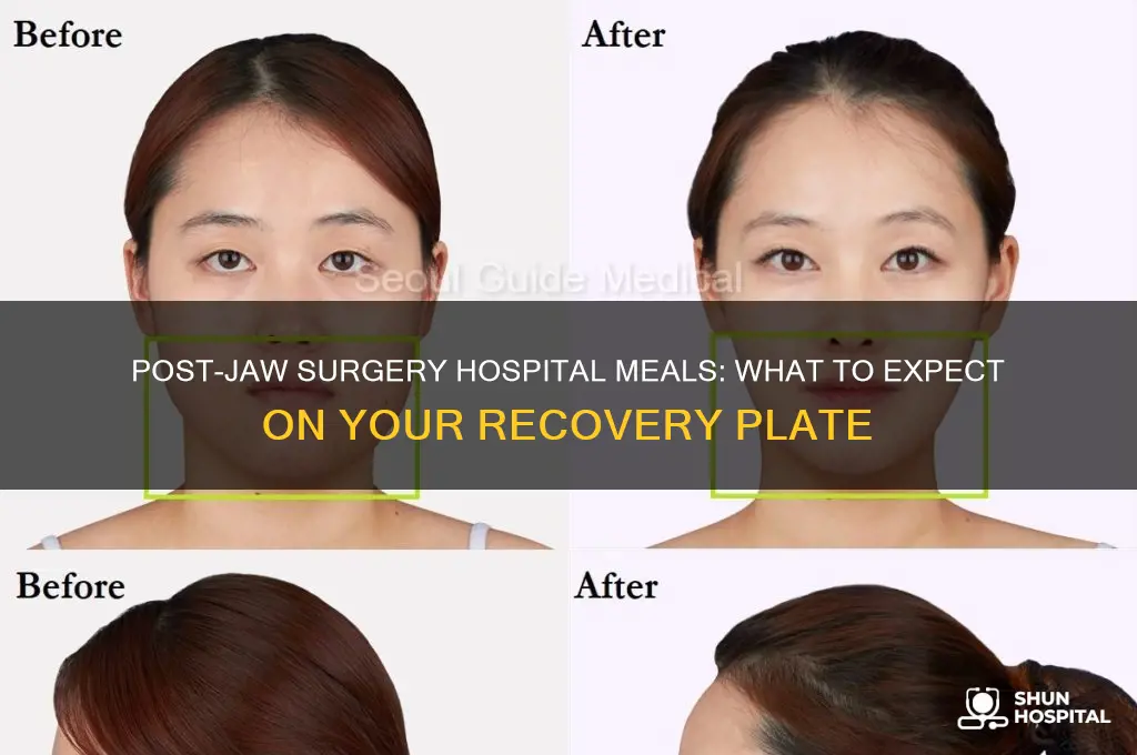 what does the hospital feed you after jaw surgery