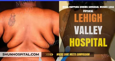 Surgical Weight Loss at Lehigh Valley Hospital: Procedure Insights