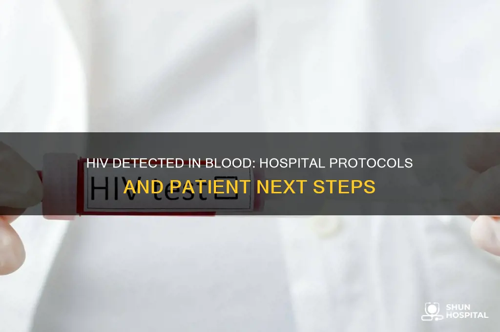 what happens if a hospital detect hiv in blood
