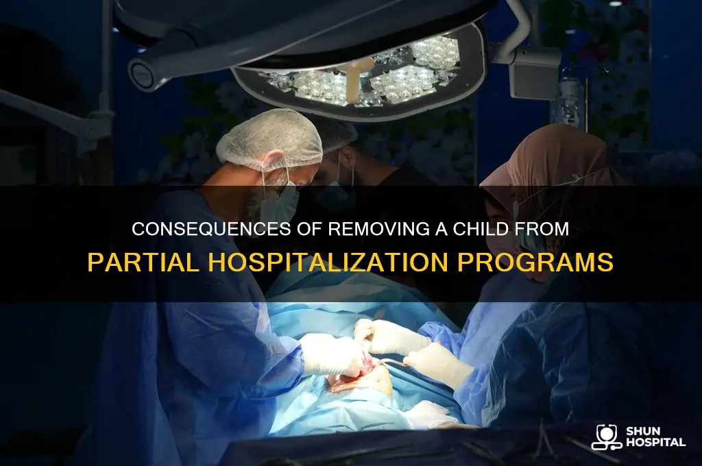 what happens if you remove child from partial hospitalization program