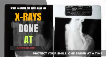 Elvis Presley's X-Ray Hospital: Uncovering the Medical Mystery