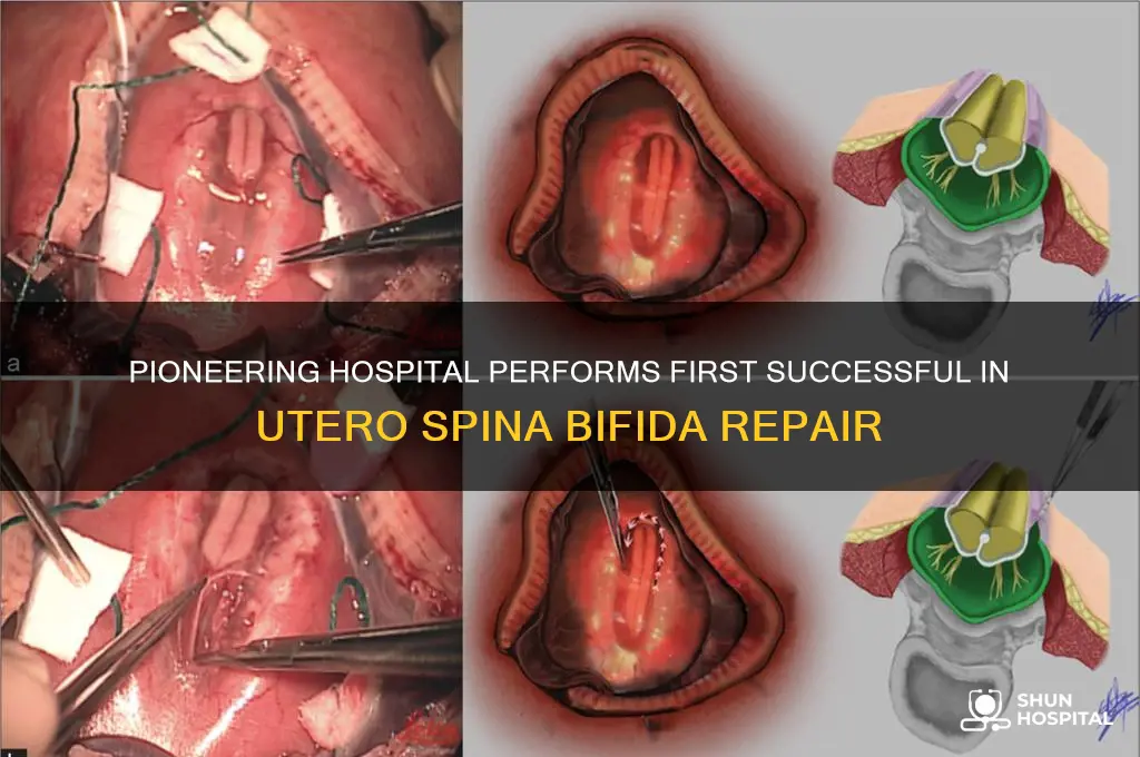 what hospital ergormed the first introuterine spina bifida repair