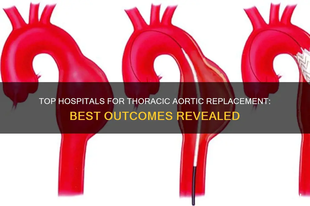 what hospital has the best outcomes for thoracic aortic replacement