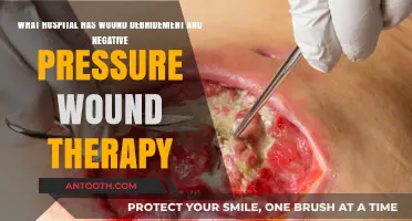 Top Hospitals Offering Wound Debridement and Negative Pressure Therapy Services