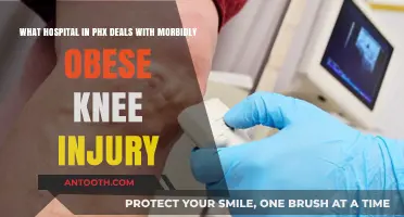 Phoenix Hospitals Specializing in Morbid Obesity Knee Injury Care