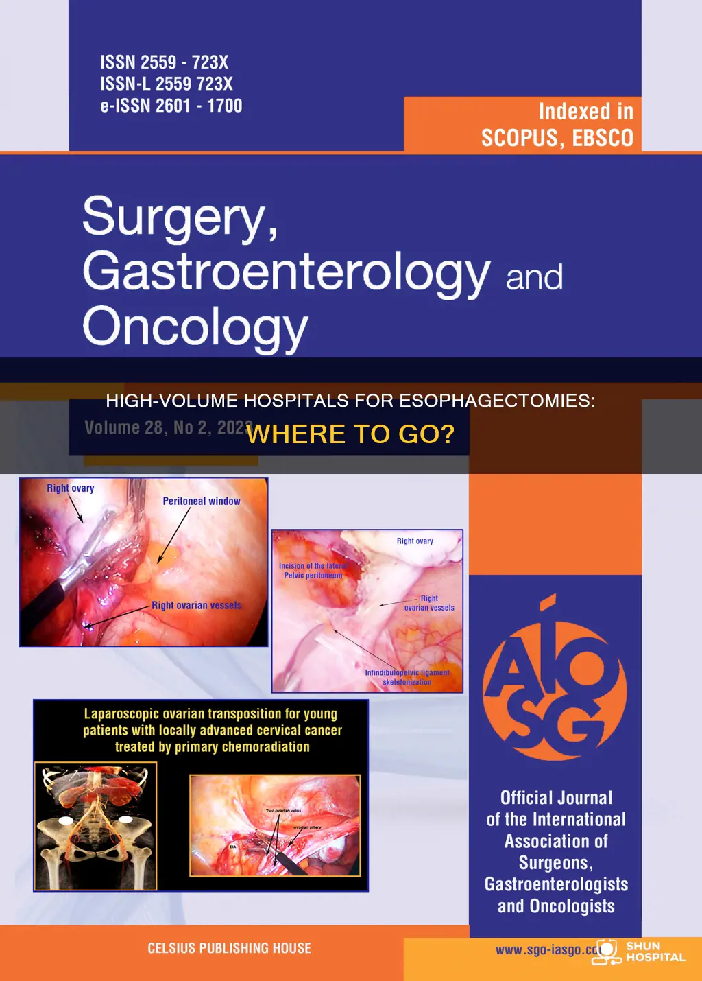 what hospital preforms high volume of esophagectomies