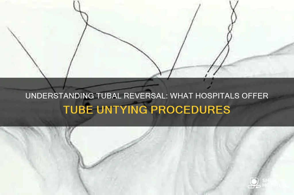 what hospital untie tubes
