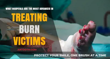 Top Advanced Hospitals for Burn Victim Treatment and Recovery