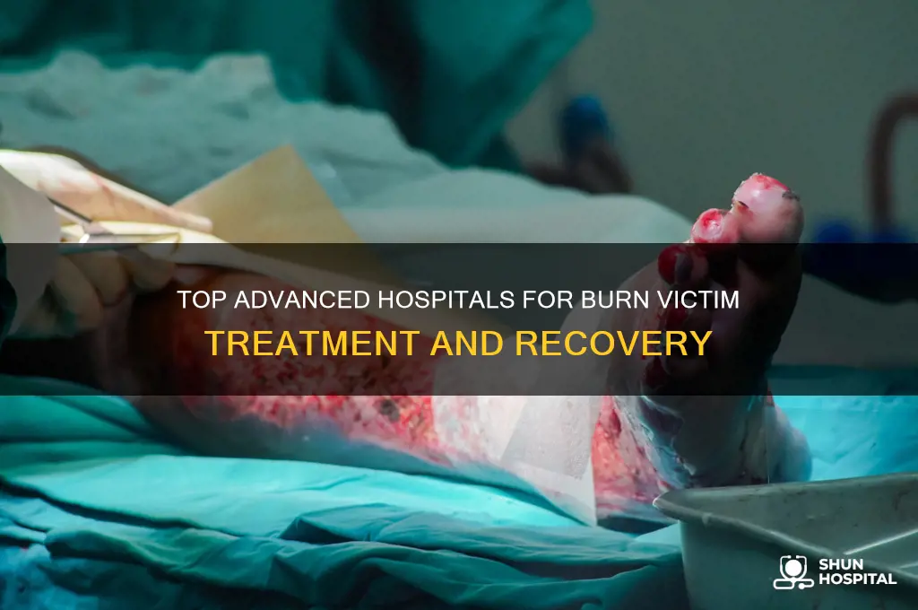 what hospitals are the most advanced in treating burn victims