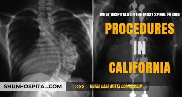 Top California Hospitals for Spinal Fusion Procedures: A Comprehensive Guide