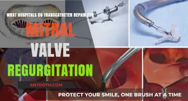 Transcatheter Mitral Valve Repair: Hospitals Offering Innovative Regurgitation Solutions