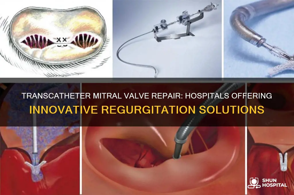 what hospitals do transcatheter repair for mitral valve regurgitation