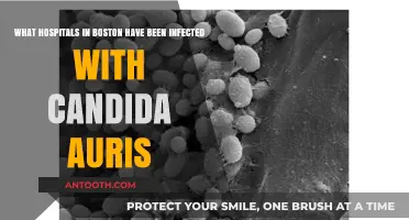 Boston Hospitals Battling Candida Auris Outbreaks: Which Ones Are Affected?