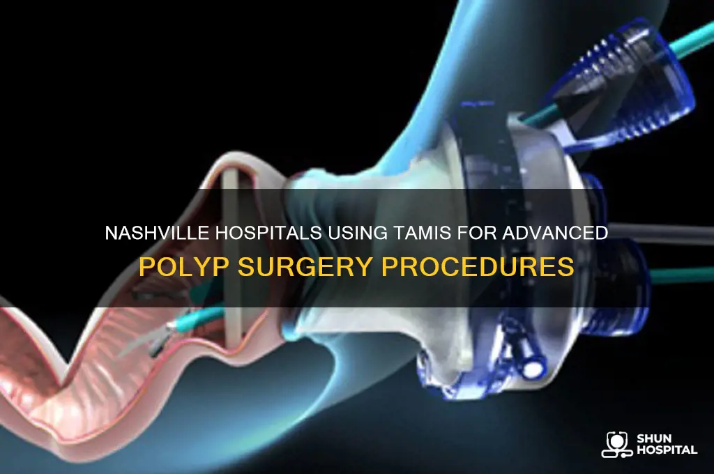 what hospitals in nashville utilize tamis for surgery of polyps