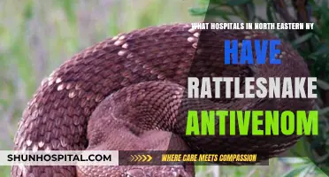Where to Find Rattlesnake Antivenom in Northeastern NY Hospitals