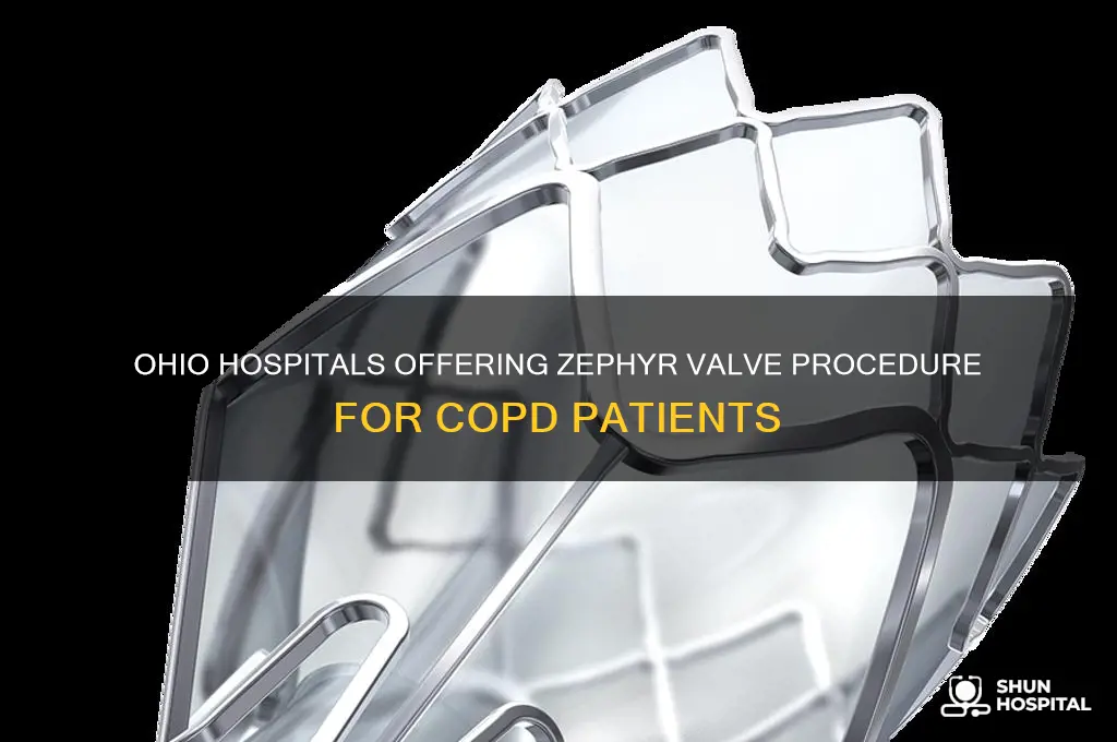 what hospitals in ohio perform the zephyr valve procedure