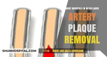 Wisconsin Hospitals Offering Laser Artery Plaque Removal: A Comprehensive Guide