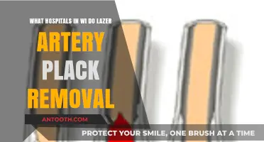 Wisconsin Hospitals Offering Laser Artery Plaque Removal Procedures