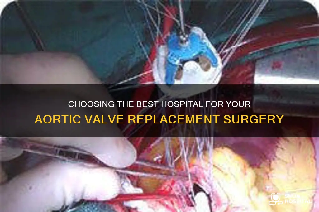 what hospitals should i have aortic valve replacement done