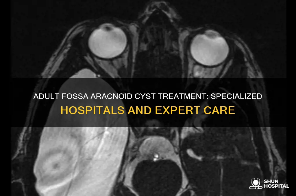 what hospitals specialize in fossa aracnoid cysts for adults