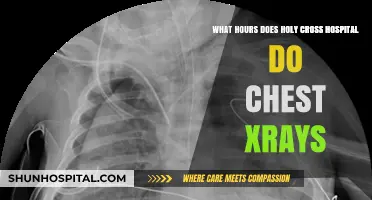 Holy Cross Hospital Chest X-Ray Hours: Schedule and Availability