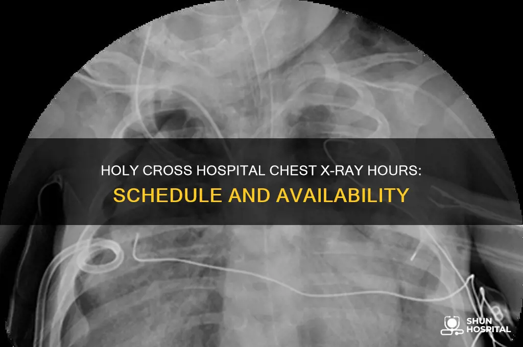what hours does holy cross hospital do chest xrays