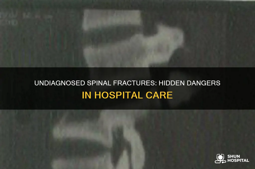 what if a spinal fracture goes undiagnosed in the hospital