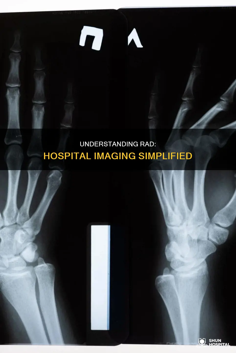 what is a rad in the hospital