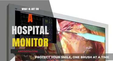 Art on Hospital Monitors: Creative Comfort for Patients