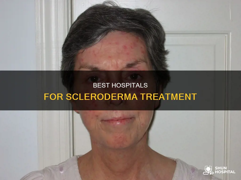 what is best hospital to treat scleroderma