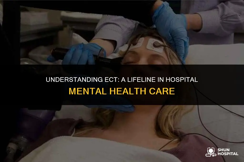 what is ect in hospital