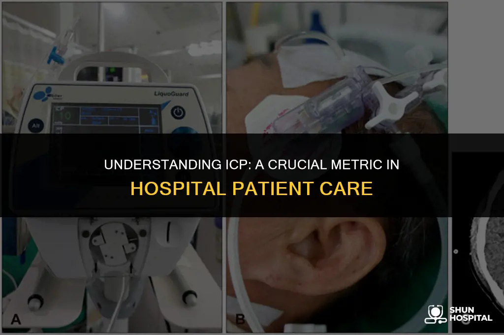 what is icp in hospital