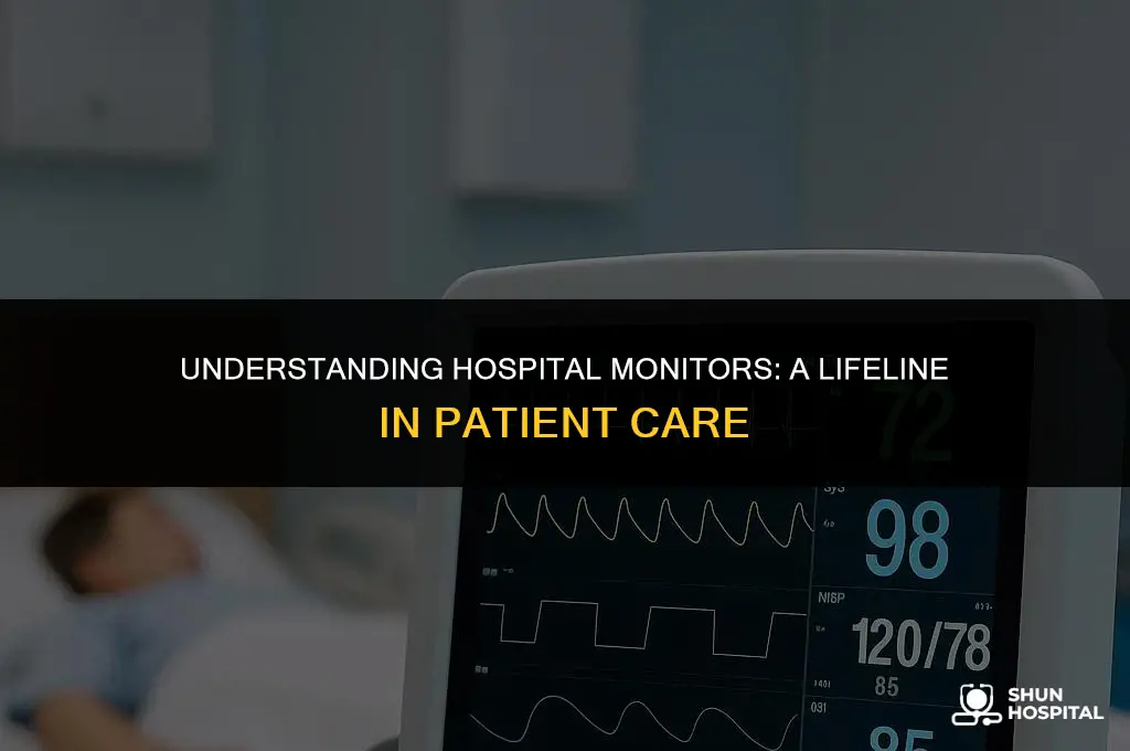 what is monitor in hospital