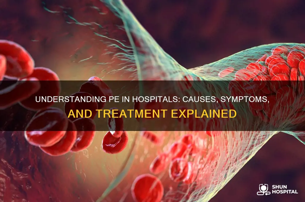 what is pe in hospital