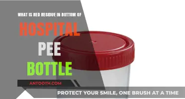 Red Residue in Hospital Pee Bottles: Causes and Concerns