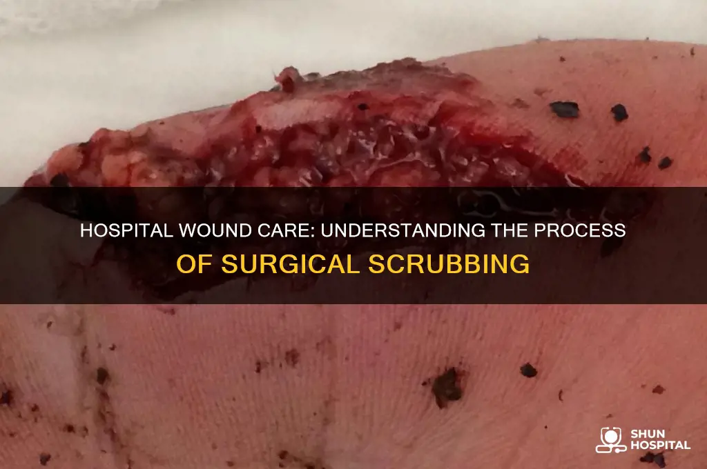 what is scrubbing a wound in a hospital called