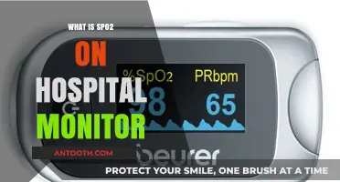 Understanding SpO2: A Crucial Metric on Hospital Monitors