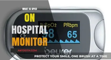 Understanding SpO2: A Crucial Metric on Hospital Monitors