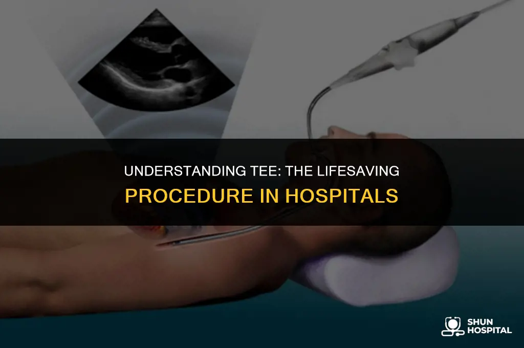 what is tee in hospital
