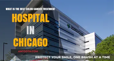 Top Chicago Hospitals for Colon Cancer Treatment: Expert Care Guide