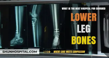 Top Hospitals for Crushed Lower Leg Bone Treatment and Recovery