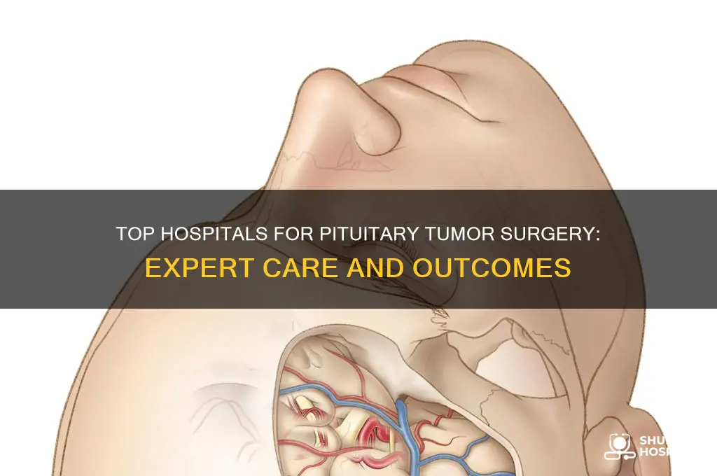 what is the best hospital for pituitary tumor surgery